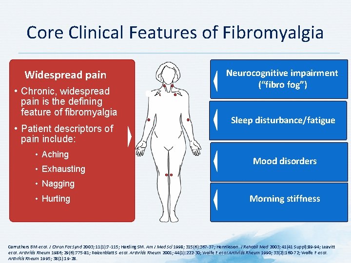 Core Clinical Features of Fibromyalgia Widespread pain • Chronic, widespread pain is the defining