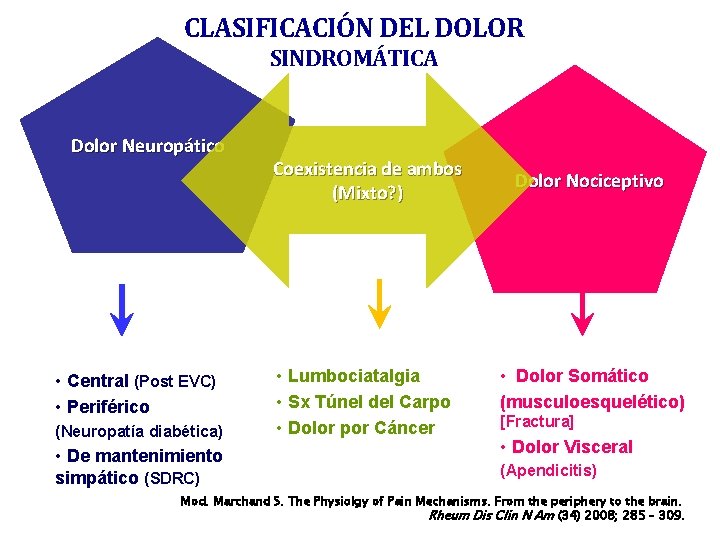 CLASIFICACIÓN DEL DOLOR SINDROMÁTICA Dolor Neuropático • Central (Post EVC) • Periférico (Neuropatía diabética)