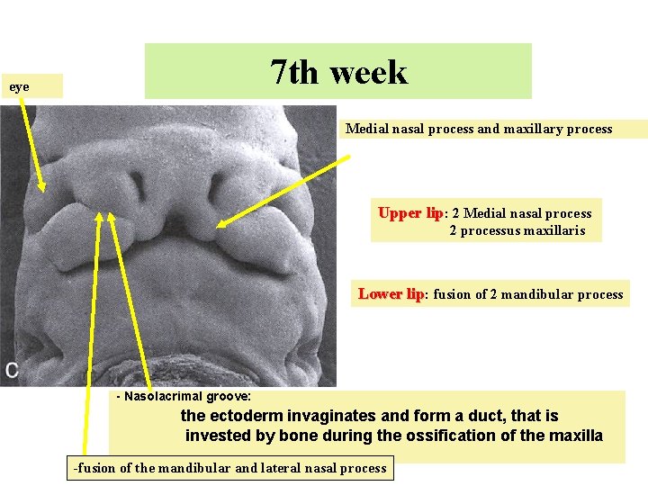 7 th week eye Medial nasal process and maxillary process Upper lip: 2 Medial