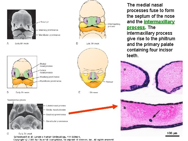 The medial nasal processes fuse to form the septum of the nose and the