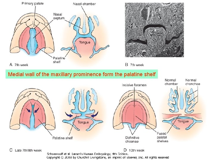 Medial wall of the maxillary prominence form the palatine shelf 