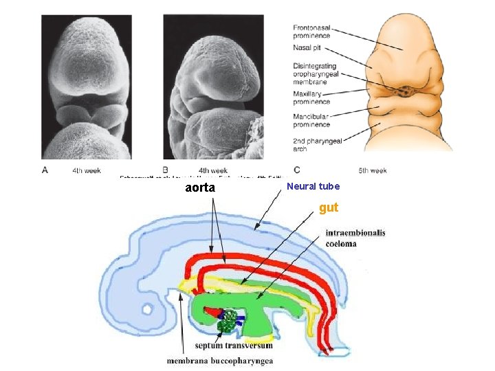 aorta Neural tube gut 