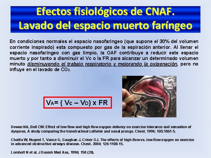 Efectos fisiológicos de CNAF. Lavado del espacio muerto faríngeo En condiciones normales el espacio