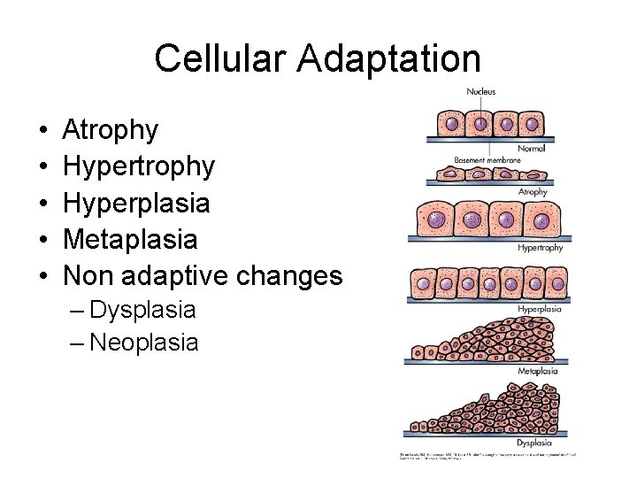 Cellular Adaptation • • • Atrophy Hyperplasia Metaplasia Non adaptive changes – Dysplasia –