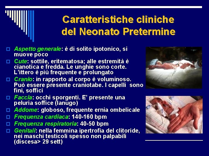 Caratteristiche cliniche del Neonato Pretermine o Aspetto generale: è di solito ipotonico, si o