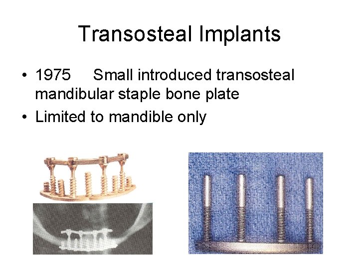 Transosteal Implants • 1975 Small introduced transosteal mandibular staple bone plate • Limited to