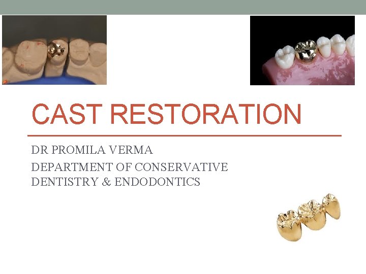 CAST RESTORATION DR PROMILA VERMA DEPARTMENT OF CONSERVATIVE DENTISTRY & ENDODONTICS 