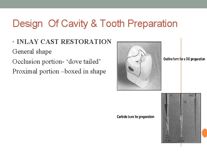 Design Of Cavity & Tooth Preparation • INLAY CAST RESTORATION General shape Occlusion portion-