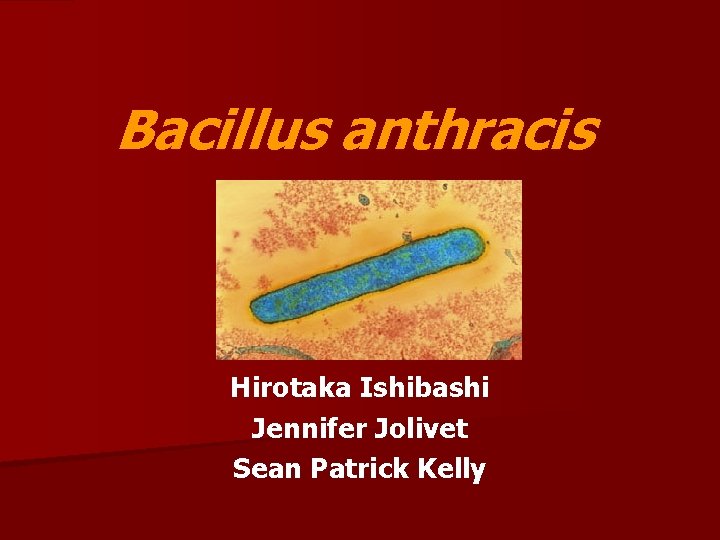 Bacillus anthracis Hirotaka Ishibashi Jennifer Jolivet Sean Patrick Kelly 