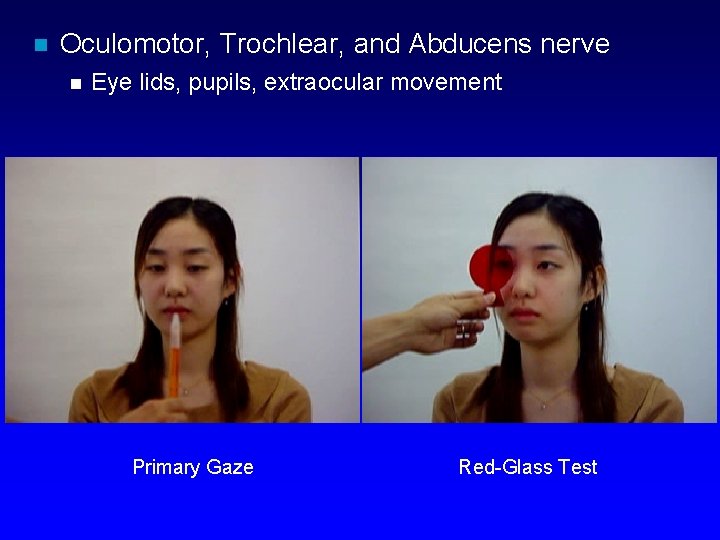 n Oculomotor, Trochlear, and Abducens nerve n Eye lids, pupils, extraocular movement Primary Gaze