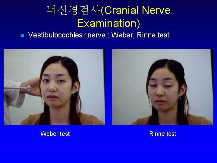 뇌신경검사(Cranial Nerve Examination) n Vestibulocochlear nerve : Weber, Rinne test Weber test Rinne test