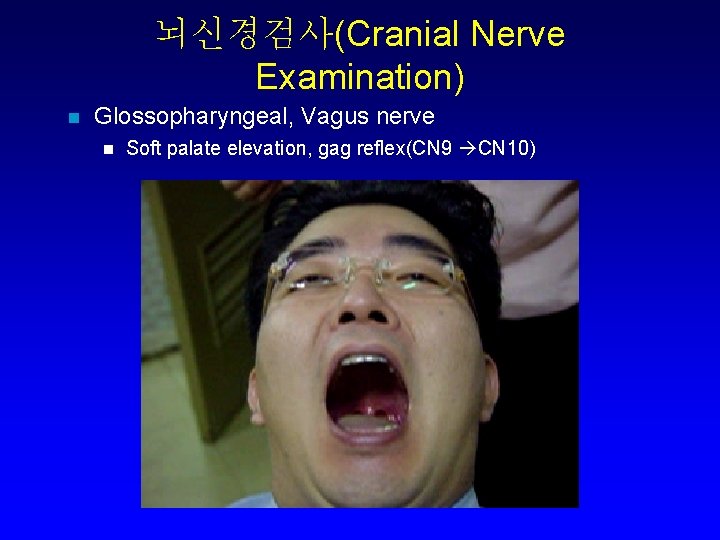 뇌신경검사(Cranial Nerve Examination) n Glossopharyngeal, Vagus nerve n Soft palate elevation, gag reflex(CN 9