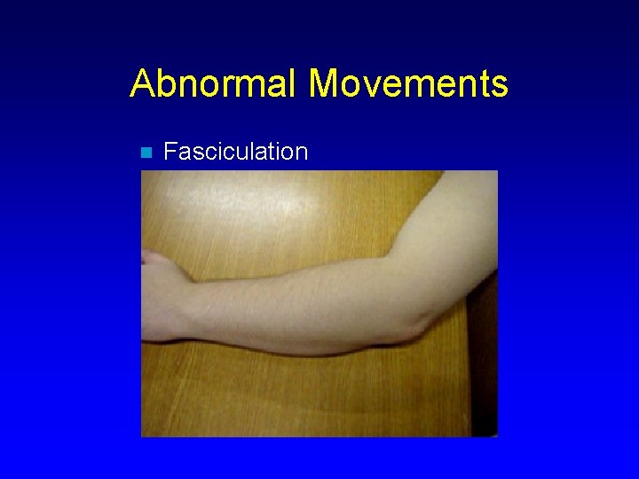 Abnormal Movements n Fasciculation 