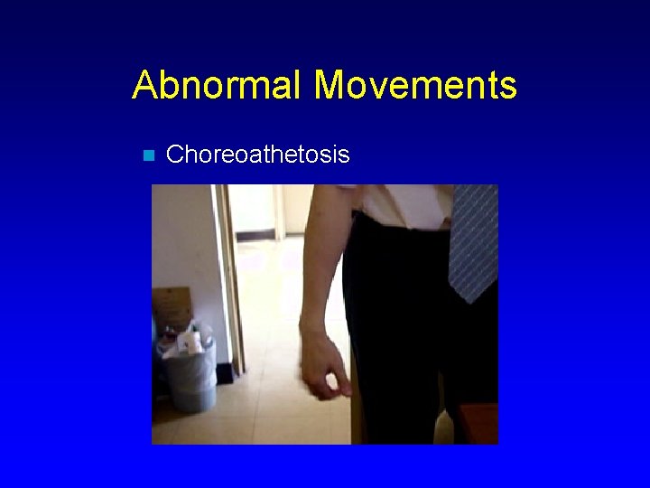 Abnormal Movements n Choreoathetosis 