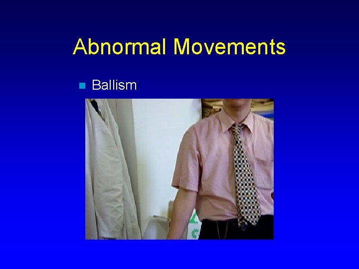 Abnormal Movements n Ballism 