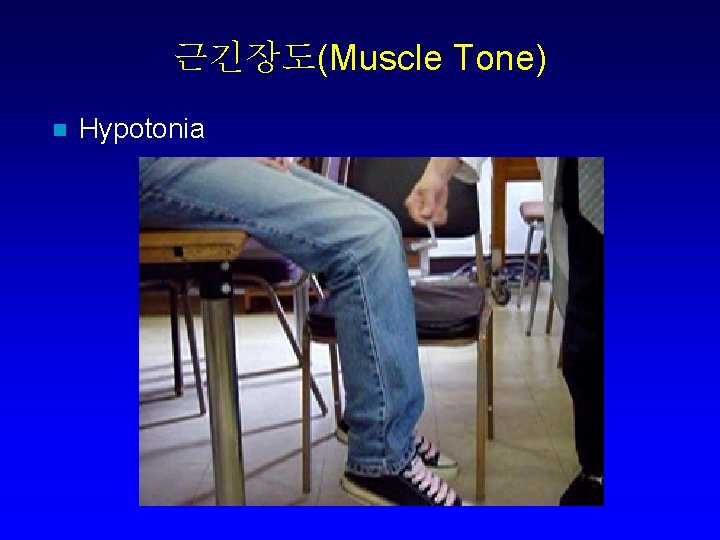 근긴장도(Muscle Tone) n Hypotonia 