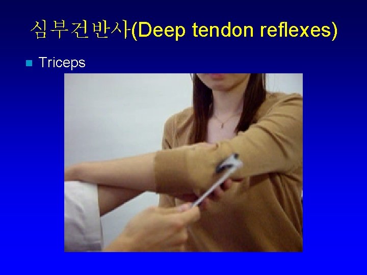 심부건반사(Deep tendon reflexes) n Triceps 
