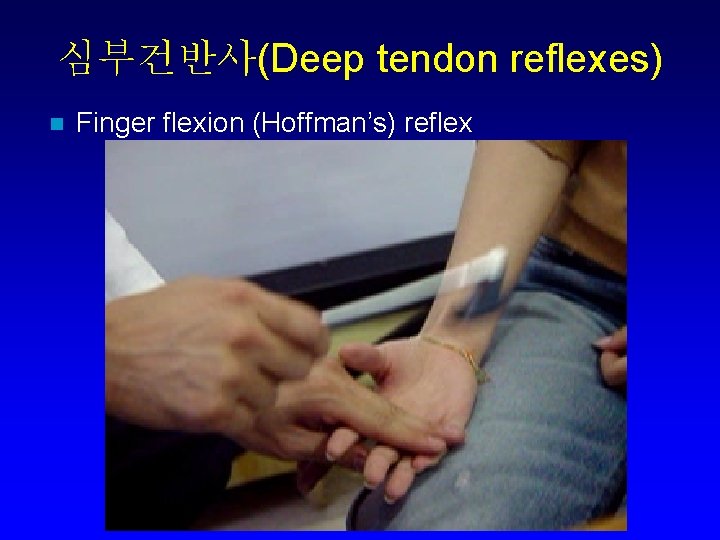 심부건반사(Deep tendon reflexes) n Finger flexion (Hoffman’s) reflex 