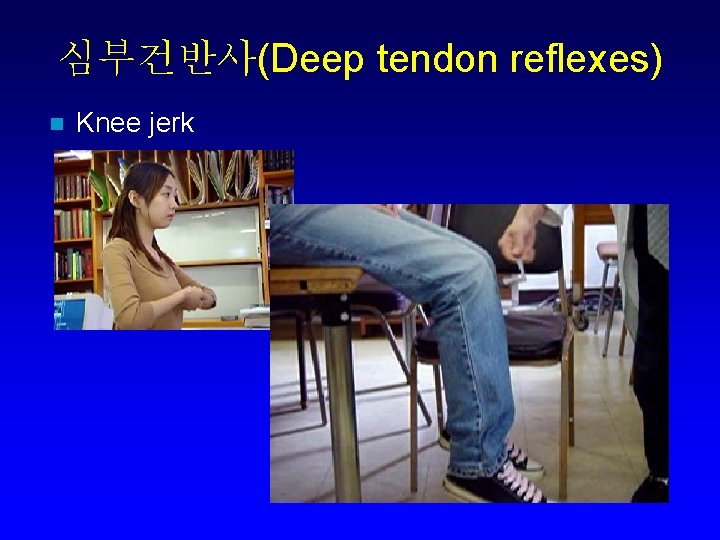심부건반사(Deep tendon reflexes) n Knee jerk 