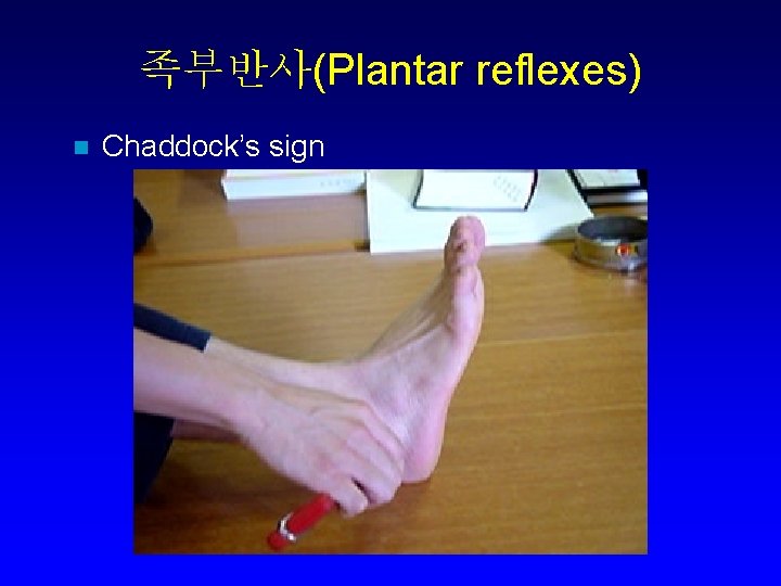 족부반사(Plantar reflexes) n Chaddock’s sign 