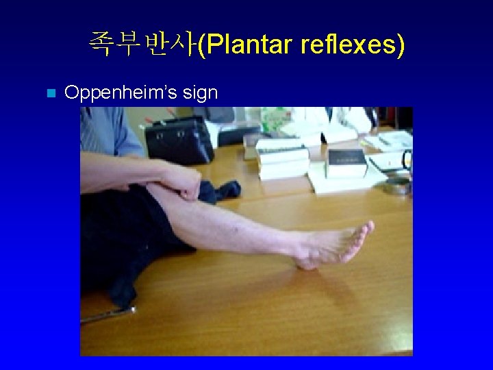족부반사(Plantar reflexes) n Oppenheim’s sign 