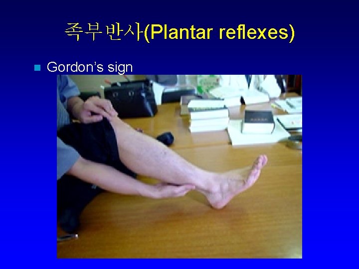 족부반사(Plantar reflexes) n Gordon’s sign 