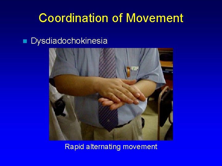 Coordination of Movement n Dysdiadochokinesia Rapid alternating movement 