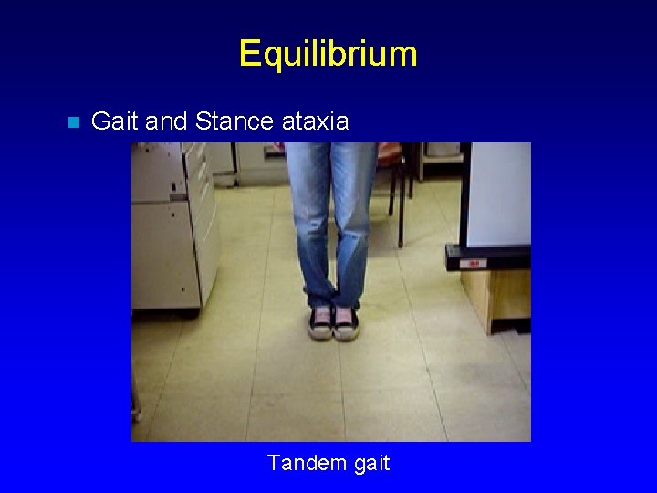 Equilibrium n Gait and Stance ataxia Tandem gait 