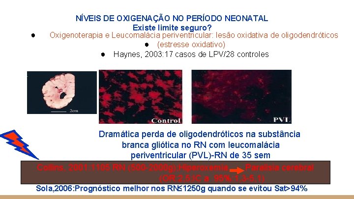 ● NÍVEIS DE OXIGENAÇÃO NO PERÍODO NEONATAL Existe limite seguro? Oxigenoterapia e Leucomalácia periventricular: