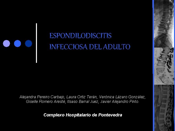 ESPONDILODISCITIS INFECCIOSA DEL ADULTO Alejandra Pereiro Carbajo, Laura Ortiz Terán, Verónica Lázaro González, Giselle