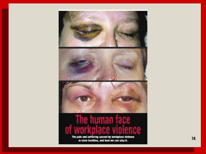 Human face 74 
