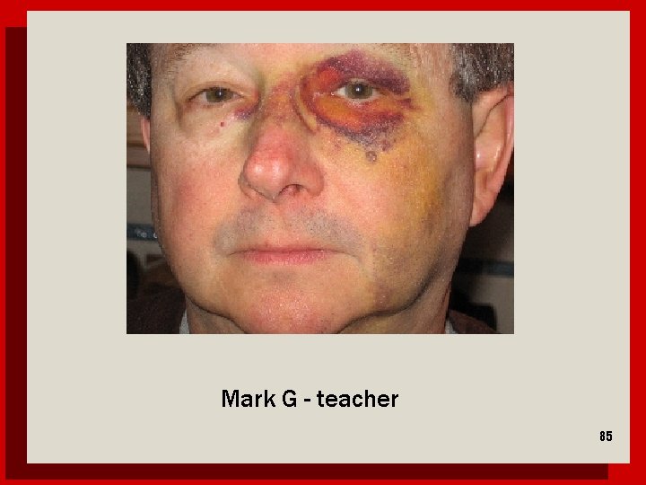 Mark G - teacher 85 