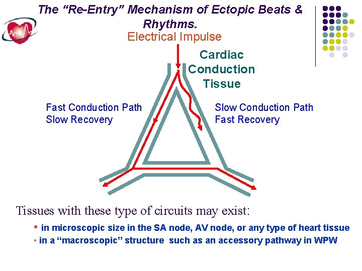 The “Re-Entry” Mechanism of Ectopic Beats & Rhythms. Electrical Impulse Cardiac Conduction Tissue Fast