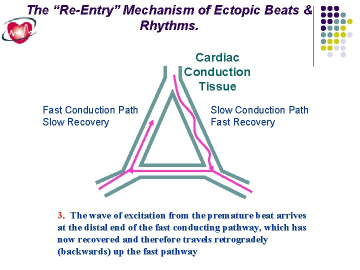 The “Re-Entry” Mechanism of Ectopic Beats & Rhythms. Cardiac Conduction Tissue Fast Conduction Path