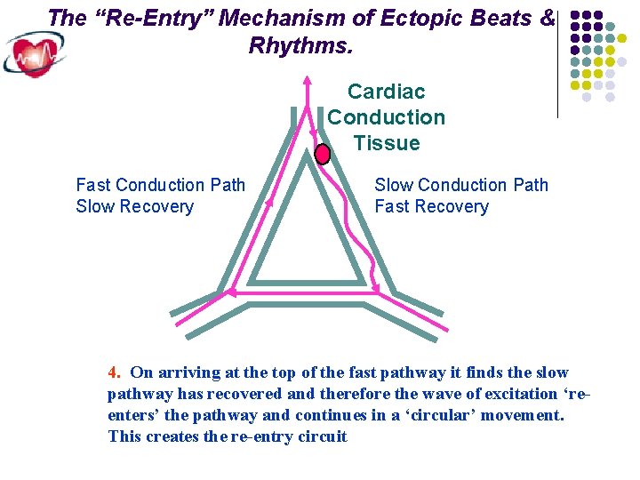 The “Re-Entry” Mechanism of Ectopic Beats & Rhythms. Cardiac Conduction Tissue Fast Conduction Path