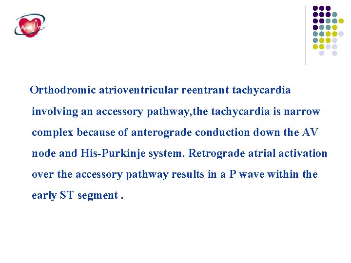 Orthodromic atrioventricular reentrant tachycardia involving an accessory pathway, the tachycardia is narrow complex because