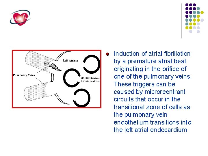 Induction of atrial fibrillation by a premature atrial beat originating in the orifice of