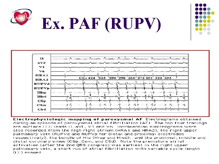 Ex. PAF (RUPV) 