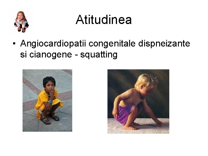 Atitudinea • Angiocardiopatii congenitale dispneizante si cianogene - squatting 