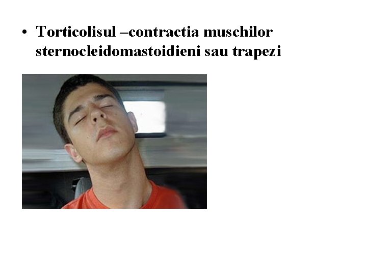  • Torticolisul –contractia muschilor sternocleidomastoidieni sau trapezi 