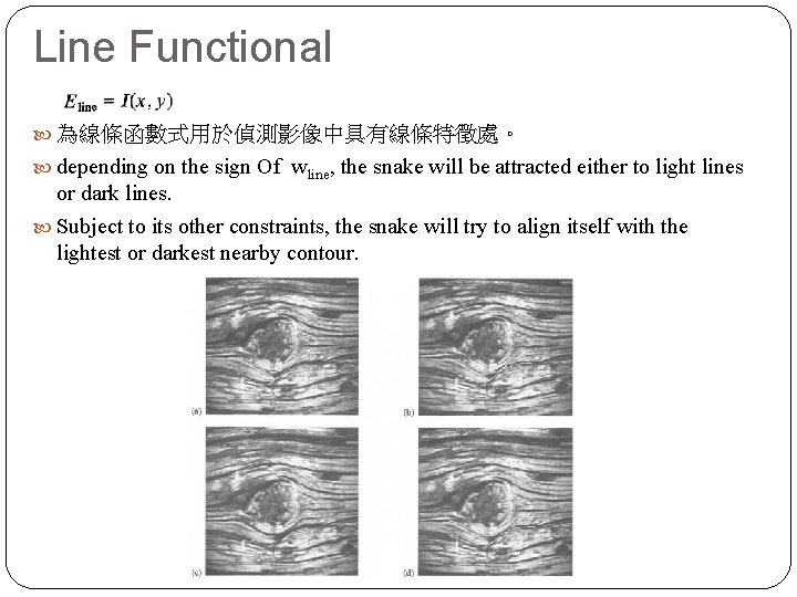 Line Functional 為線條函數式用於偵測影像中具有線條特徵處。 depending on the sign Of wline, the snake will be attracted