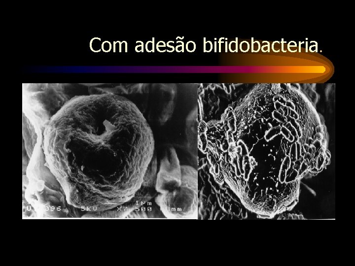 Com adesão bifidobacteria. 