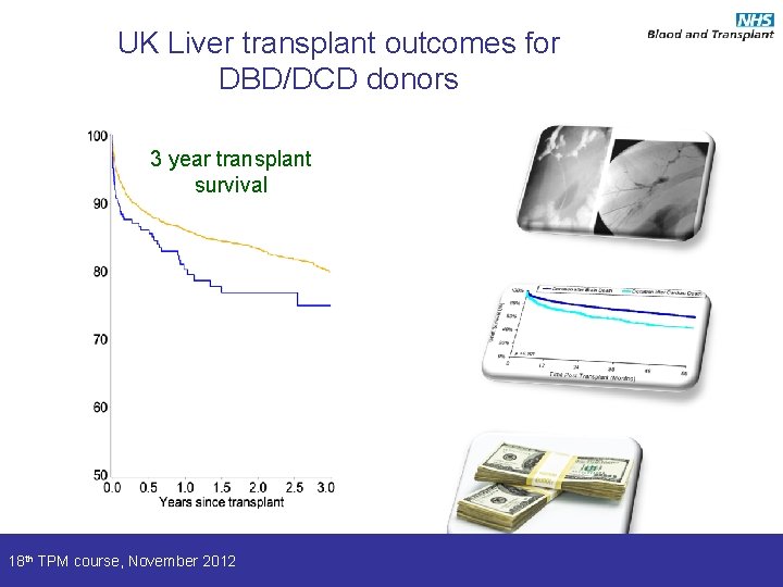 UK Liver transplant outcomes for DBD/DCD donors 3 year transplant survival 18 th TPM
