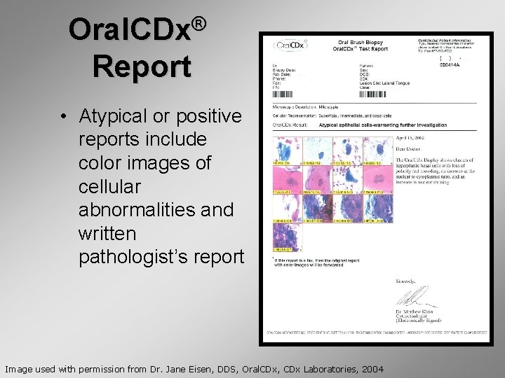 ® Oral. CDx Report • Atypical or positive reports include color images of cellular