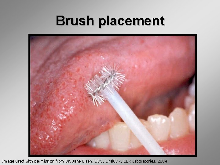 Module 4 Screening and Diagnosis Diagnosis Definitive diagnosis