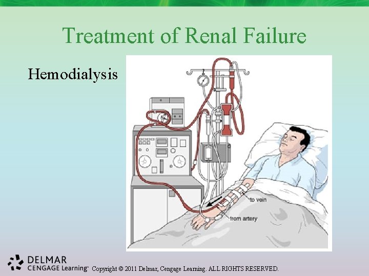 Treatment of Renal Failure Hemodialysis Copyright © 2011 Delmar, Cengage Learning. ALL RIGHTS RESERVED.