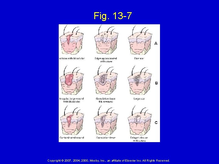 Fig. 13 -7 Copyright © 2007, 2004, 2000, Mosby, Inc. , an affiliate of