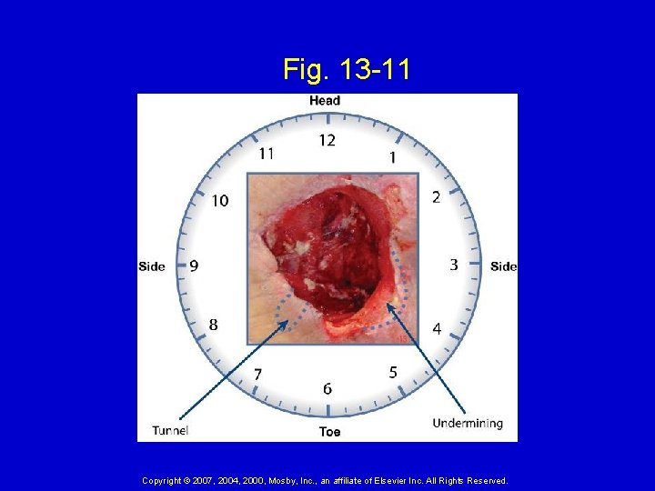 Fig. 13 -11 Copyright © 2007, 2004, 2000, Mosby, Inc. , an affiliate of