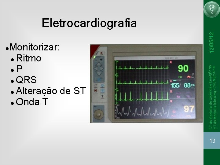 12/05/12 Monitorizar: Ritmo P QRS Alteração de ST Onda T CT de Medicina 12/05/12 Monitorizar: Ritmo P QRS Alteração de ST Onda T CT de Medicina