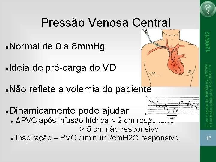 Normal de 0 a 8 mm. Hg Ideia de pré-carga do VD Não reflete Normal de 0 a 8 mm. Hg Ideia de pré-carga do VD Não reflete